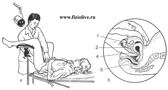 Общая схема к статье гинекологический массаж